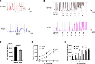 High glucose induced HIF-1α/TREK1 expression and myometrium relaxation during pregnancy